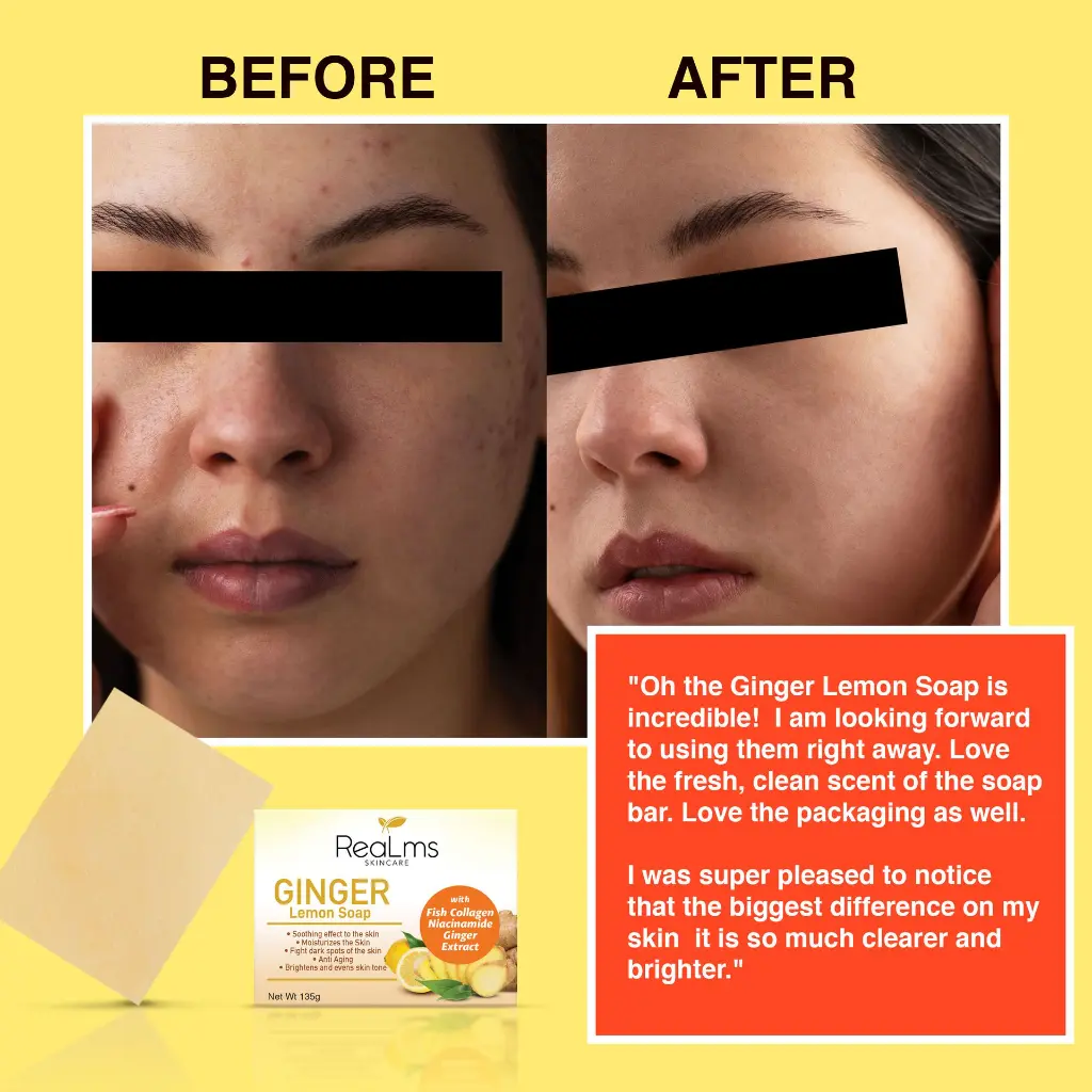 before and after.webp