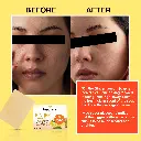 before and after.webp